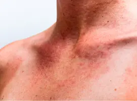 Teste Molecular para o Zika Vírus