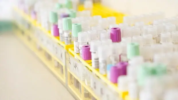 Planos terão que oferecer teste rápido de dengue, determina ANS