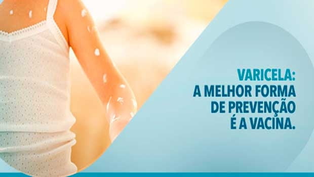 Varicela: A melhor forma de prevenção é a vacina